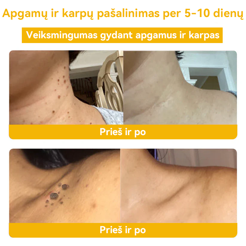 šā
Oficiali parduotuvÄ: šš²š¢š¤šš²ā¢šš¢Äš¢Å³ šš®šØššš¢ šš²ššØš¦šš¬š¢š¬ šš«šš¦šš¬šØāāļøPatvirtinta Lietuvos dermatologų asociacijos (LDD)