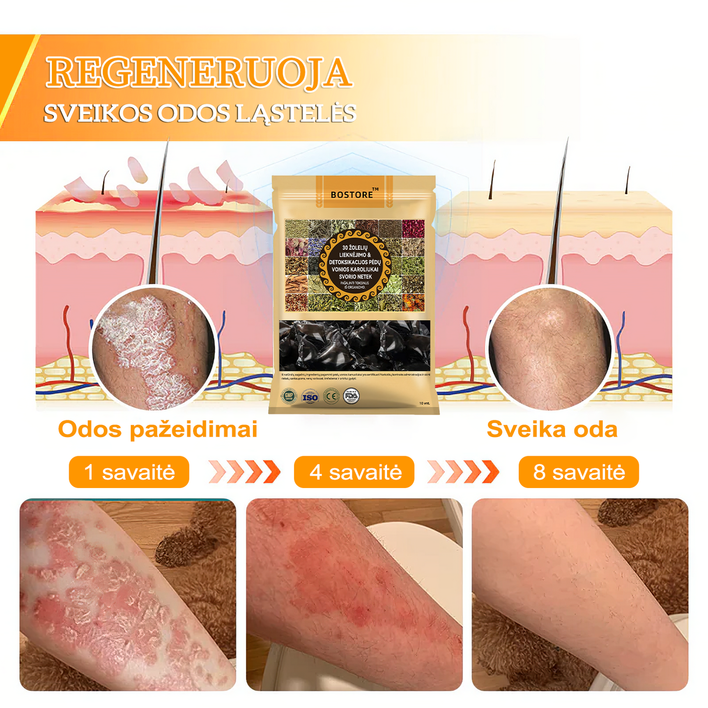 🌷𝐁𝐨𝐬𝐭𝐨𝐫𝐞™ 🌷𝟑𝟎 Ž𝐨𝐥𝐞𝐥𝐢ų 𝐋𝐢𝐞𝐤𝐧ė𝐣𝐢𝐦𝐨 & 𝐃𝐞𝐭𝐨𝐤𝐬𝐢𝐤𝐚𝐜𝐢𝐣𝐨𝐬 𝐏ė𝐝ų 𝐕𝐨𝐧𝐢𝐨𝐬 𝐊𝐚𝐫𝐨𝐥𝐢𝐮𝐤𝐚𝐢 𝐒𝐯𝐨𝐫𝐢𝐨 𝐍𝐞𝐭𝐞𝐤-- (LANA sertifikavimas, Britų limfodrenažinė asociacija)🎉🎉