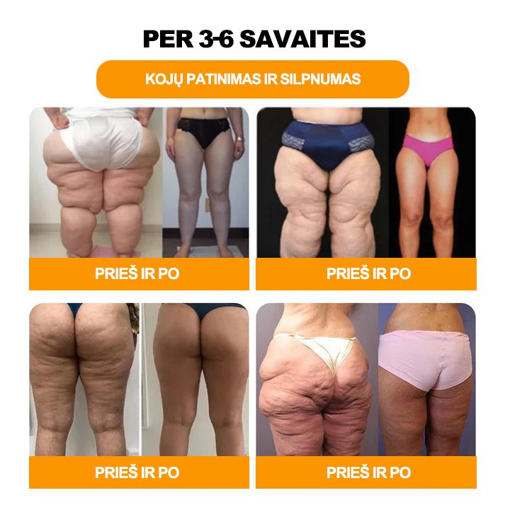🌷𝐁𝐨𝐬𝐭𝐨𝐫𝐞™ 🌷𝟑𝟎 Ž𝐨𝐥𝐞𝐥𝐢ų 𝐋𝐢𝐞𝐤𝐧ė𝐣𝐢𝐦𝐨 & 𝐃𝐞𝐭𝐨𝐤𝐬𝐢𝐤𝐚𝐜𝐢𝐣𝐨𝐬 𝐏ė𝐝ų 𝐕𝐨𝐧𝐢𝐨𝐬 𝐊𝐚𝐫𝐨𝐥𝐢𝐮𝐤𝐚𝐢 𝐒𝐯𝐨𝐫𝐢𝐨 𝐍𝐞𝐭𝐞𝐤-- (LANA sertifikavimas, Britų limfodrenažinė asociacija)🎉🎉