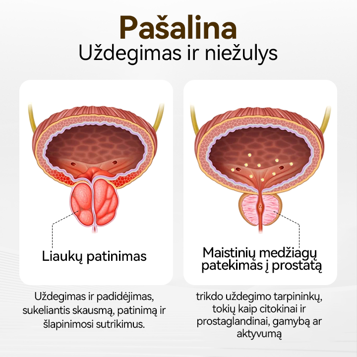 🔱🔆🔆CZTICLE™ ProstaVibe Bičių sveikatos inhaliatorius