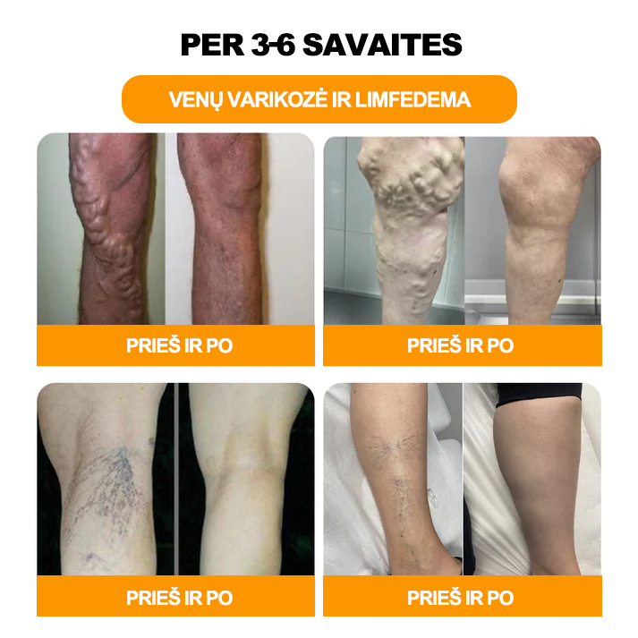 🌷𝐁𝐨𝐬𝐭𝐨𝐫𝐞™ 🌷𝟑𝟎 Ž𝐨𝐥𝐞𝐥𝐢ų 𝐋𝐢𝐞𝐤𝐧ė𝐣𝐢𝐦𝐨 & 𝐃𝐞𝐭𝐨𝐤𝐬𝐢𝐤𝐚𝐜𝐢𝐣𝐨𝐬 𝐏ė𝐝ų 𝐕𝐨𝐧𝐢𝐨𝐬 𝐊𝐚𝐫𝐨𝐥𝐢𝐮𝐤𝐚𝐢 𝐒𝐯𝐨𝐫𝐢𝐨 𝐍𝐞𝐭𝐞𝐤-- (LANA sertifikavimas, Britų limfodrenažinė asociacija)🎉🎉