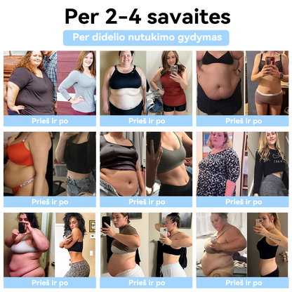 (🍍𝐏𝐀𝐒𝐊𝐔𝐓𝐈𝐍Ė 𝐃𝐈𝐄𝐍𝐀 𝟕𝟎% 𝐍𝐔𝐎𝐋𝐀𝐈𝐃𝐀🍍) 𝐒𝐂𝐍𝐃𝐑™ 𝐮𝐥𝐭𝐫𝐚𝐠𝐚𝐫𝐬𝐢𝐧ė 𝐫𝐢𝐞𝐛𝐚𝐥ų š𝐚𝐥𝐢𝐧𝐢𝐦𝐨 𝐢𝐫 𝐭𝐨𝐥𝐢𝐦𝐨𝐣𝐨 𝐢𝐧𝐟𝐫𝐚𝐫𝐚𝐮𝐝𝐨𝐧ų𝐣ų 𝐬𝐩𝐢𝐧𝐝𝐮𝐥𝐢ų 𝐜𝐮𝐤𝐫𝐚𝐮𝐬 𝐤𝐢𝐞𝐤𝐢𝐨 𝐤𝐫𝐚𝐮𝐣𝐲𝐣𝐞 𝐛𝐚𝐥𝐚𝐧𝐬𝐚𝐯𝐢𝐦𝐨 𝐚𝐩𝐲𝐫𝐚𝐧𝐤ė 𝐃𝐞𝐭𝐨𝐱