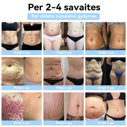 (🍍𝐏𝐀𝐒𝐊𝐔𝐓𝐈𝐍Ė 𝐃𝐈𝐄𝐍𝐀 𝟕𝟎% 𝐍𝐔𝐎𝐋𝐀𝐈𝐃𝐀🍍) 𝐒𝐂𝐍𝐃𝐑™ 𝐮𝐥𝐭𝐫𝐚𝐠𝐚𝐫𝐬𝐢𝐧ė 𝐫𝐢𝐞𝐛𝐚𝐥ų š𝐚𝐥𝐢𝐧𝐢𝐦𝐨 𝐢𝐫 𝐭𝐨𝐥𝐢𝐦𝐨𝐣𝐨 𝐢𝐧𝐟𝐫𝐚𝐫𝐚𝐮𝐝𝐨𝐧ų𝐣ų 𝐬𝐩𝐢𝐧𝐝𝐮𝐥𝐢ų 𝐜𝐮𝐤𝐫𝐚𝐮𝐬 𝐤𝐢𝐞𝐤𝐢𝐨 𝐤𝐫𝐚𝐮𝐣𝐲𝐣𝐞 𝐛𝐚𝐥𝐚𝐧𝐬𝐚𝐯𝐢𝐦𝐨 𝐚𝐩𝐲𝐫𝐚𝐧𝐤ė 𝐃𝐞𝐭𝐨𝐱
