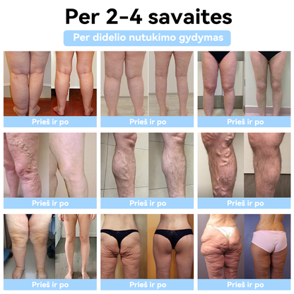 (🍍𝐏𝐀𝐒𝐊𝐔𝐓𝐈𝐍Ė 𝐃𝐈𝐄𝐍𝐀 𝟕𝟎% 𝐍𝐔𝐎𝐋𝐀𝐈𝐃𝐀🍍) 𝐒𝐂𝐍𝐃𝐑™ 𝐮𝐥𝐭𝐫𝐚𝐠𝐚𝐫𝐬𝐢𝐧ė 𝐫𝐢𝐞𝐛𝐚𝐥ų š𝐚𝐥𝐢𝐧𝐢𝐦𝐨 𝐢𝐫 𝐭𝐨𝐥𝐢𝐦𝐨𝐣𝐨 𝐢𝐧𝐟𝐫𝐚𝐫𝐚𝐮𝐝𝐨𝐧ų𝐣ų 𝐬𝐩𝐢𝐧𝐝𝐮𝐥𝐢ų 𝐜𝐮𝐤𝐫𝐚𝐮𝐬 𝐤𝐢𝐞𝐤𝐢𝐨 𝐤𝐫𝐚𝐮𝐣𝐲𝐣𝐞 𝐛𝐚𝐥𝐚𝐧𝐬𝐚𝐯𝐢𝐦𝐨 𝐚𝐩𝐲𝐫𝐚𝐧𝐤ė 𝐃𝐞𝐭𝐨𝐱
